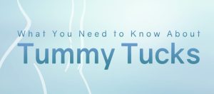 What you need to know about tummy tucks