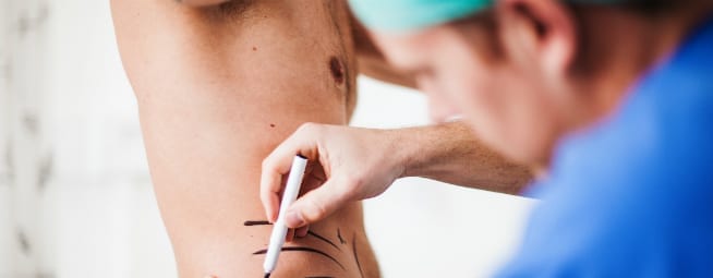 male plastic surgery trends