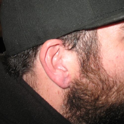 H earlobe after
