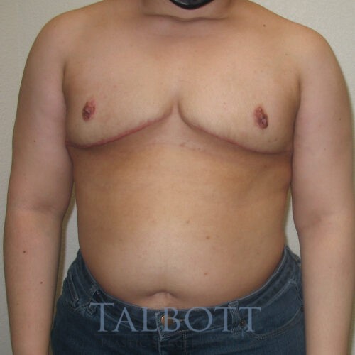 Case--5224 | After Nonbinary